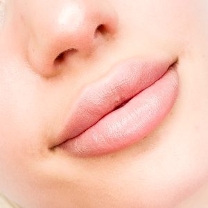 Modelowanie ust kwasem hialuronowym